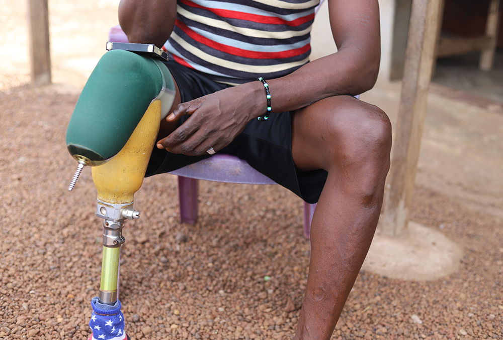 Mohamed Santigie Bangura, de 45 años, muestra las cicatrices de las heridas que sufrió durante la guerra civil de 1991-2002 en Sierra Leona. Desde que terminó el conflicto, las religiosas ayudan a supervivientes y responsables a superar el trauma y los reúnen para que se perdonen y se reconcilien. (Foto: GSR/Doreen Ajiambo)