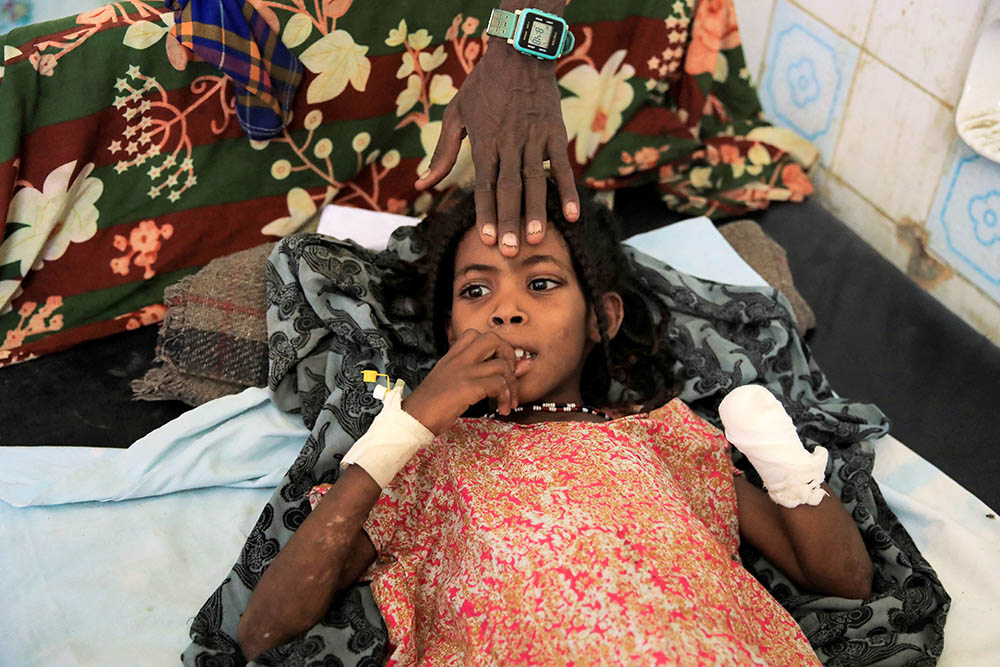 Una niña de 8 años recibe tratamiento en el hospital de referencia de Dubti, Etiopía, el 24 de febrero de 2022. La niña perdió la mano izquierda a causa de los explosivos abandonados cerca de su casa tras los combates entre la Fuerza de Defensa Nacional de Etiopía y el Frente de Liberación Popular de Tigré. (Foto: CNS/Reuters/Tiksa Negeri)