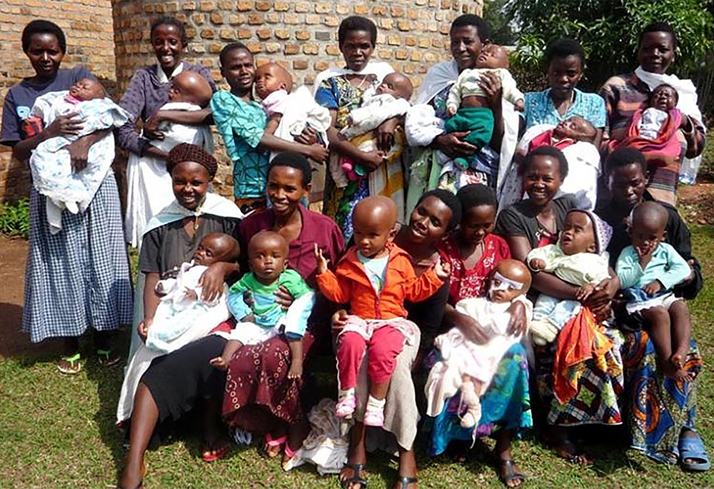 Gikonko Health Center, which the Sisters of St. Boniface run, has developed a cost-effective pediatric treatment program for hydrocephalus, a disease that mostly affects children. (GSR photo/Aimable Twahirwa)