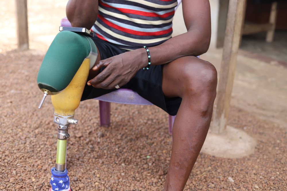 Mohamed Santigie Bangura, 45, shows off the scars of the injuries he sustained during the 1991-2002 civil war in Sierra Leone.