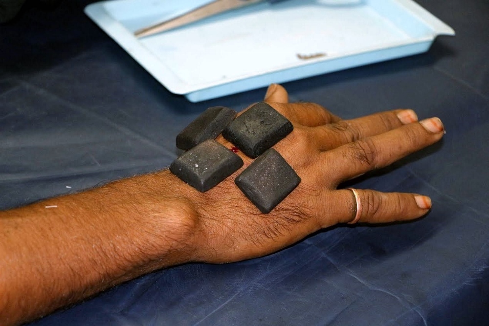 The "black stones" are the key treatment for snake and scorpion bites in a hospital managed by the Sisters of the Adoration of the Blessed Sacrament in central India. The "stone" is made from herbs found deep in the forest. (GSR photo / Saji Thomas)