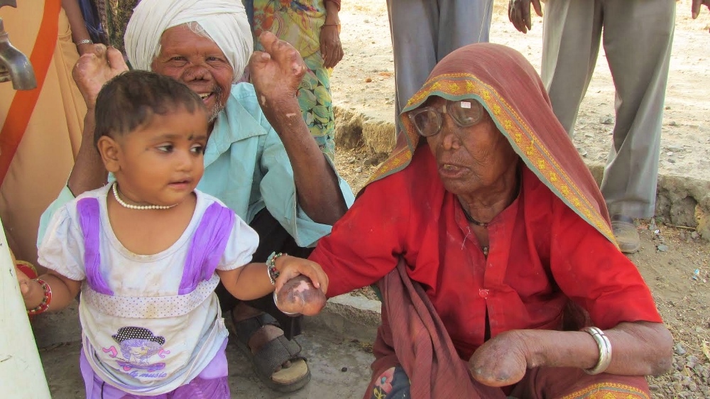 A child of a leper couple holds the hand of Sundari Bai (GSR photo / Saji Thomas)