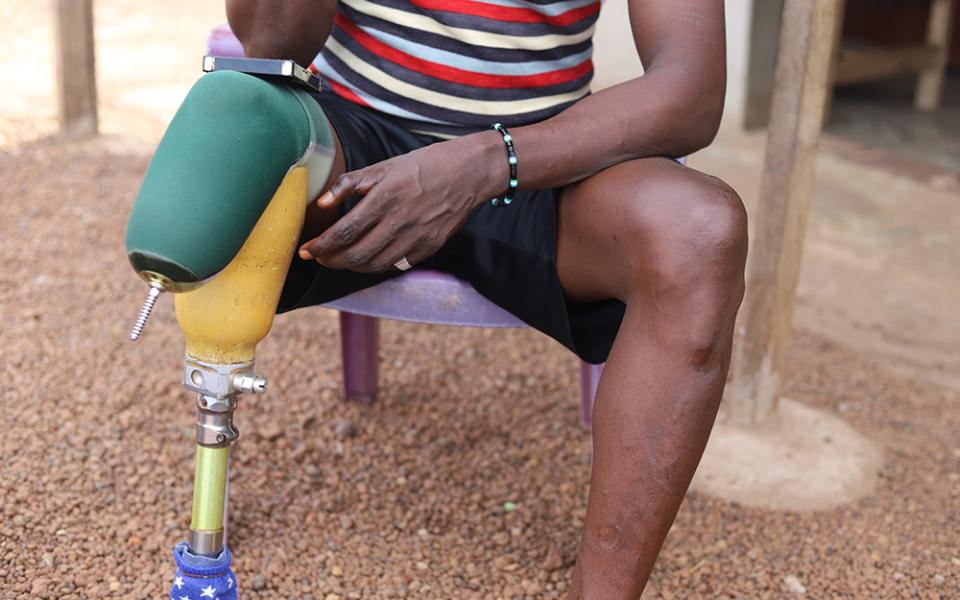 Mohamed Santigie Bangura, 45, shows off the scars of the injuries he sustained during the 1991-2002 civil war in Sierra Leone. Since the end of the civil war, religious sisters have been helping survivors and perpetrators deal with trauma and bringing them together to forgive each other and reconcile. (GSR photo/Doreen Ajiambo)